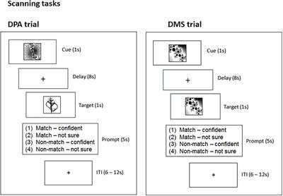 Reduced Visual and Frontal Cortex Activation During Visual Working Memory in Grapheme-Color Synaesthetes Relative to Young and Older Adults